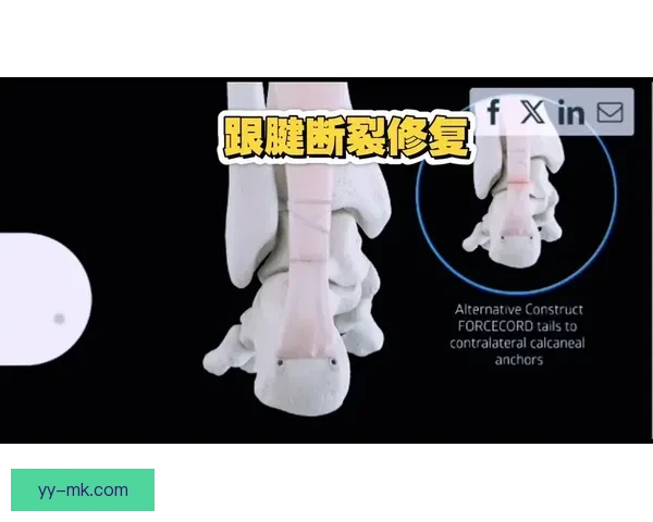 威廉·卡瓦略遭遇跟腱断裂伤势 面对艰难康复期的挑战与坚持